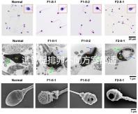 試管促排卵不同方案都適合哪些人?如何監(jiān)測排卵?
