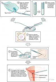 貴陽單身女性禁止凍卵?持“三證”已婚女性就能凍卵