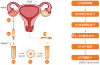 赴美考察歸來!HRC醫(yī)院的6位試管嬰兒醫(yī)生是亮點(diǎn)