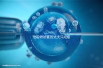 誰(shuí)說(shuō)做試管的丈夫只戒煙十天沒(méi)有影響,前一天晚上抽煙或者很難移植?