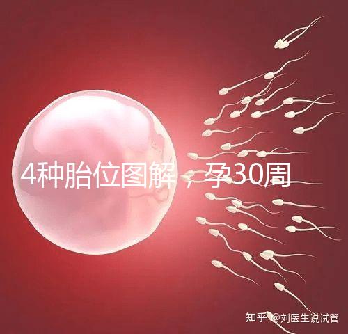 4種胎位圖解，孕30周這個姿勢最適合順產