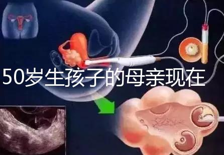 50歲生孩子的母親現在過得真不怎么樣,大齡不建議沖三胎