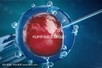 45歲懷孕藥流有風險！這4種并發癥極易影響安全