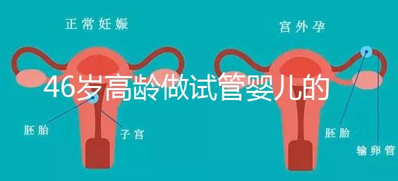 46歲高齡做試管嬰兒的成功幾率有多大？聽聽大家怎么說