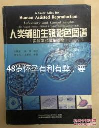 48歲懷孕有利有弊,要不要生需考慮這3點!