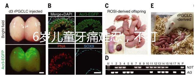 6歲兒童牙痛難忍，不打針吃藥5個小妙招快速止疼
