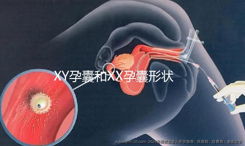 XY孕囊和XX孕囊形狀各有差異，橢圓形可能是懷女哦！