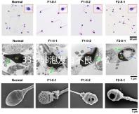 33歲卵泡發(fā)育不良,做試管黃體期促排方案失敗怎么辦?