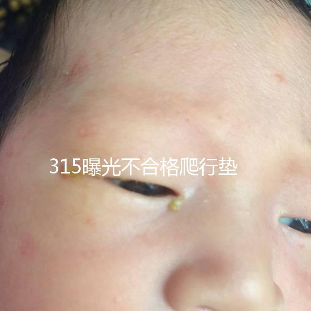 315曝光不合格爬行墊品牌，甲酰胺超標(biāo)的危害可不小