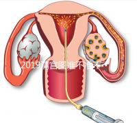 2019清宮圖準不準不知道,但檢測生男女這3種方法才科學