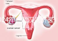 2024年,武漢同濟醫(yī)院不孕癥醫(yī)生排名公布,選擇專家迅速登記