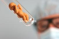 2024年陜西省規(guī)定發(fā)放獨(dú)生子女費(fèi),包括咸陽(yáng)市補(bǔ)貼標(biāo)準(zhǔn)和領(lǐng)取流程