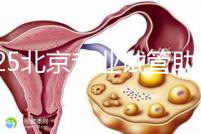 2025北京專業試管助孕機構可靠推薦來咯，這3家超棒，快碼?。?/></a></figure><h4><a target=